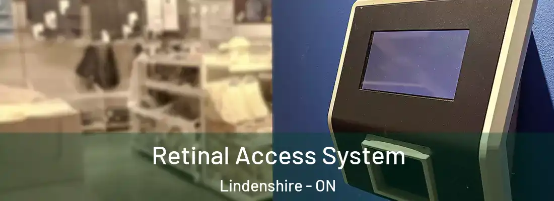  Retinal Access System Lindenshire - ON